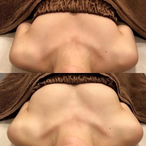 水着を着た時に胸がスカスカで悩んでいるあなた[滋賀で小顔、バストアップは小顔コルギサロンsowa]